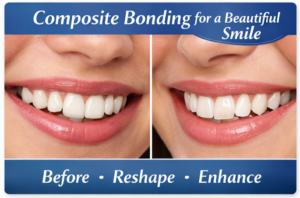 Smile of woman with great teeth to represent Dental Composite Bonding.